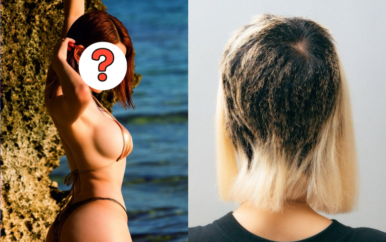 Nữ DJ suy sụp bật khóc, tóc rụng mảng lớn- Ảnh 1. Hình ảnh nữ DJ với mái tóc rụng mảng lớn